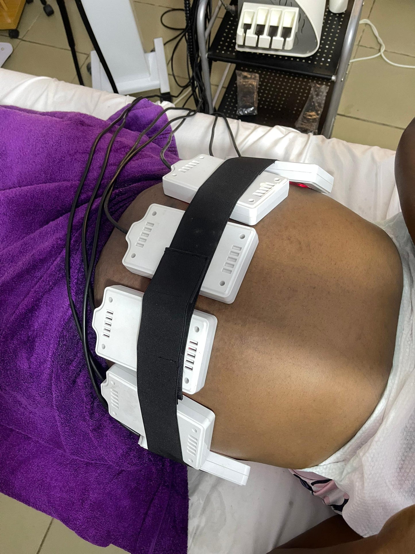 Belle fat body sculpting